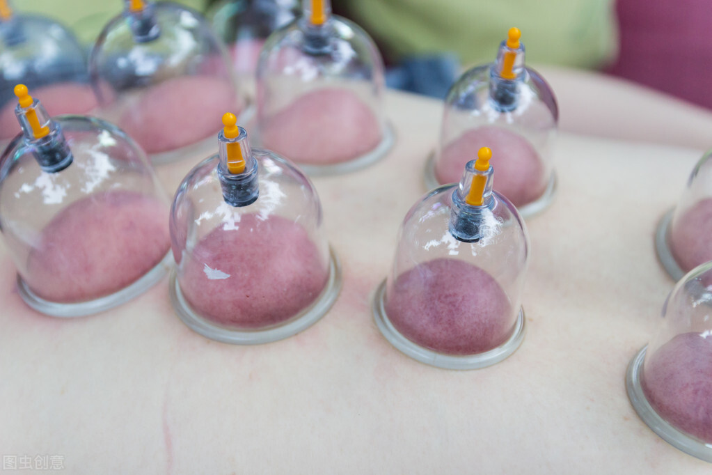 拔罐可以减肥,美容,还有哪些你不知道的好处?还有哪些注意事项