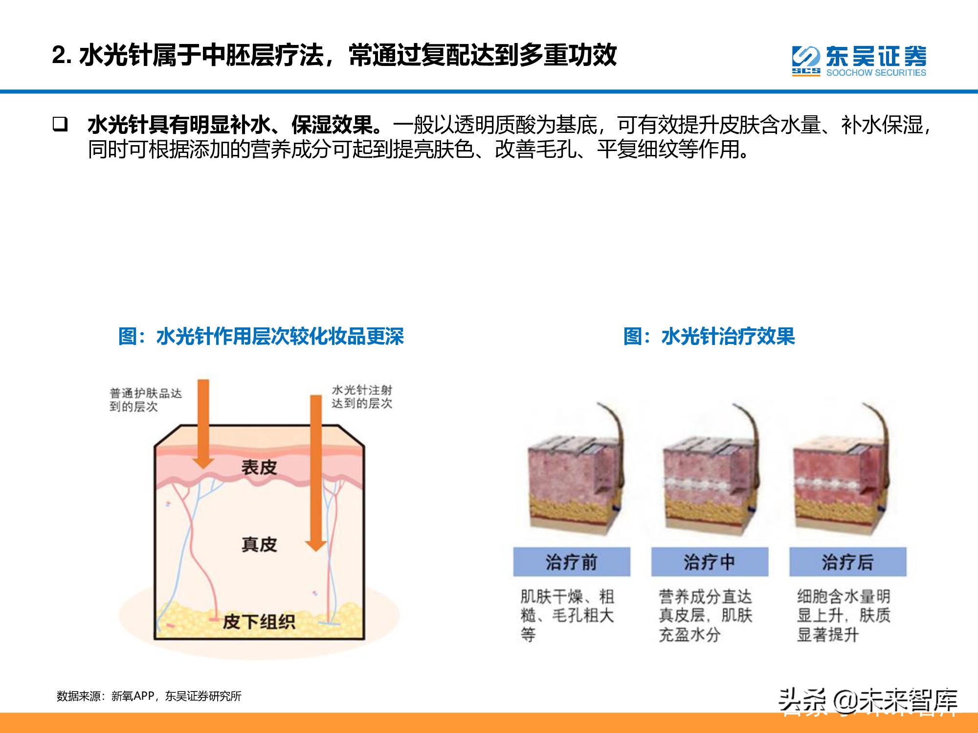 医美行业深度研究报告：进击的水光针