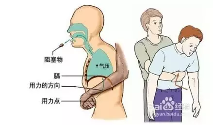 6岁男孩吃面包不幸身亡，学会这个方法，关键时刻可救命