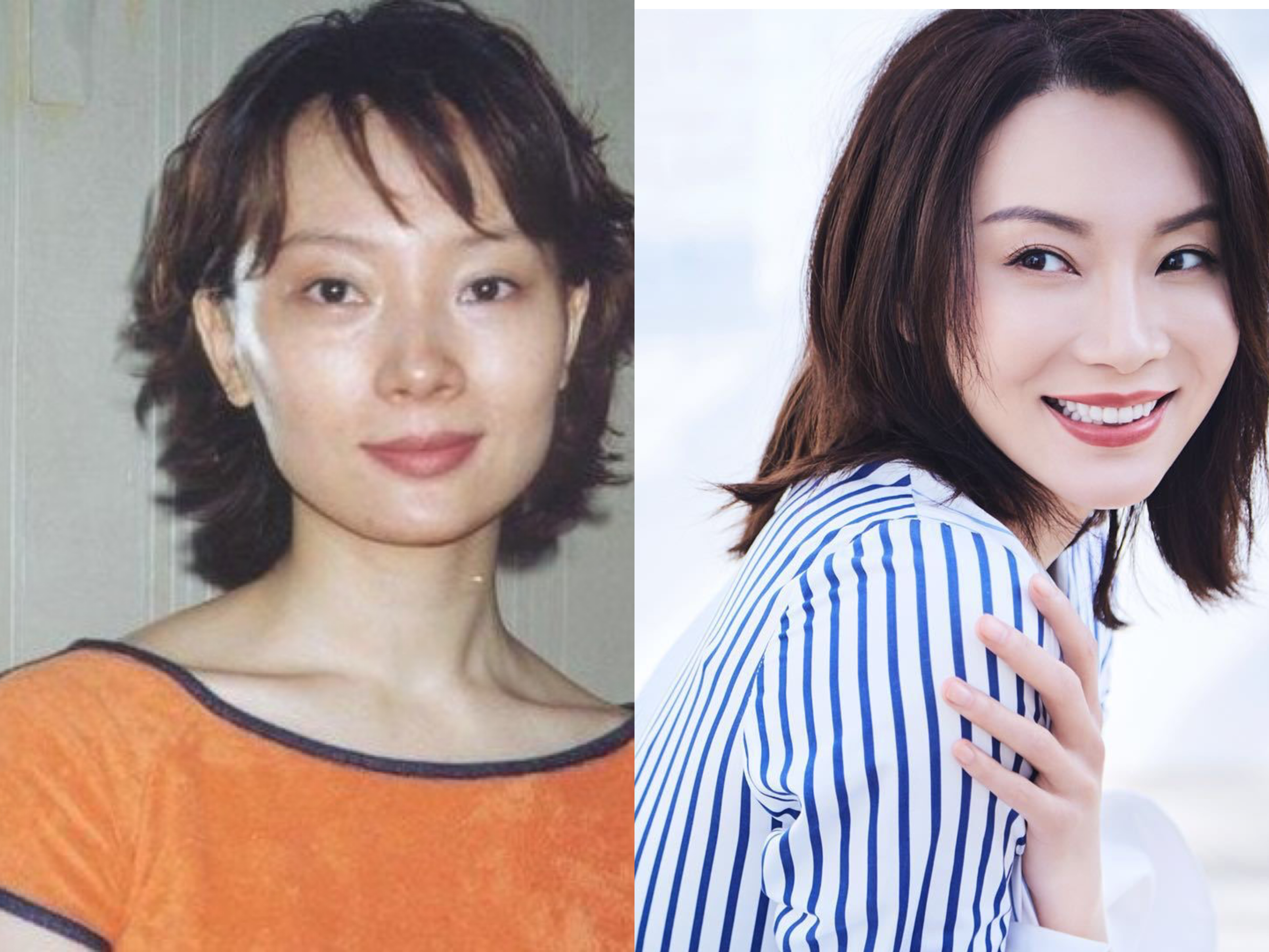 都说整容是娱乐圈“大忌”，而这10位明星，却因整容走向人生巅峰