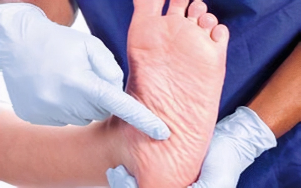 引起脚底脱皮的原因有哪些？脚脱皮的治疗方法