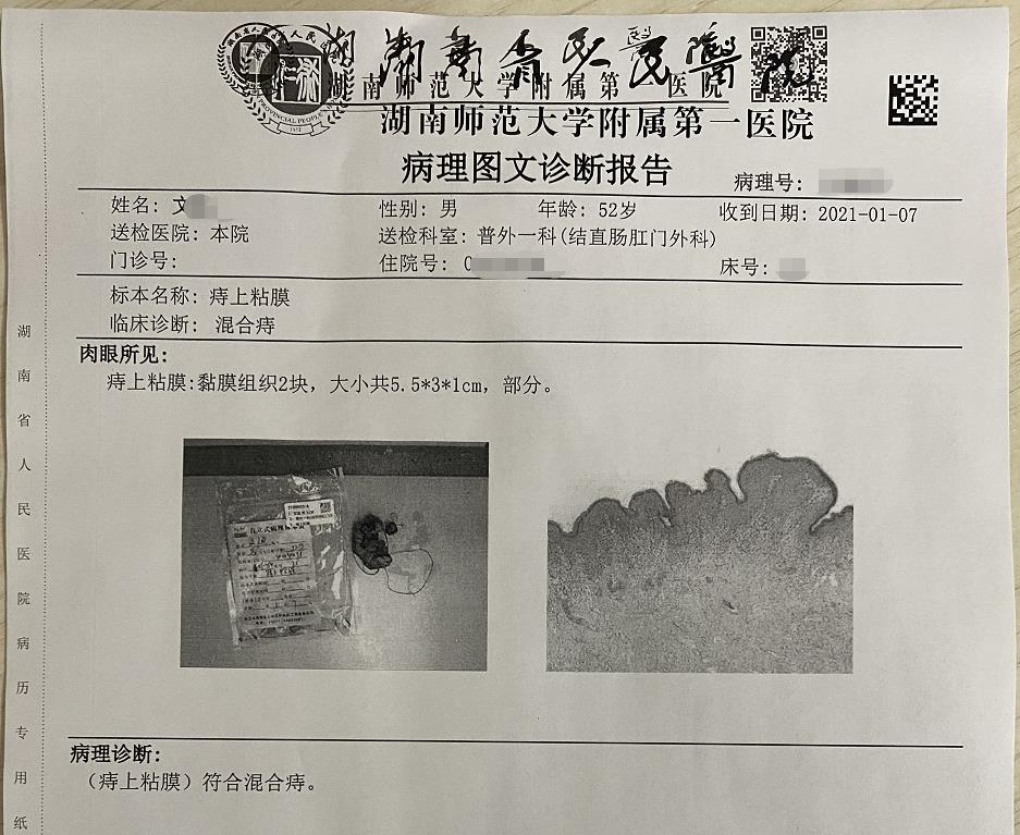从这个典型病例我们说说那些关于“痔疮”你不知道的事