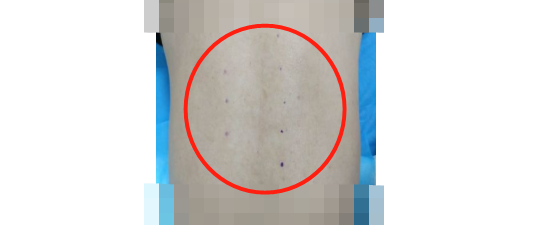 后背疼痛是怎么回事？可能和4种病有关，符合3种情况要及时就诊