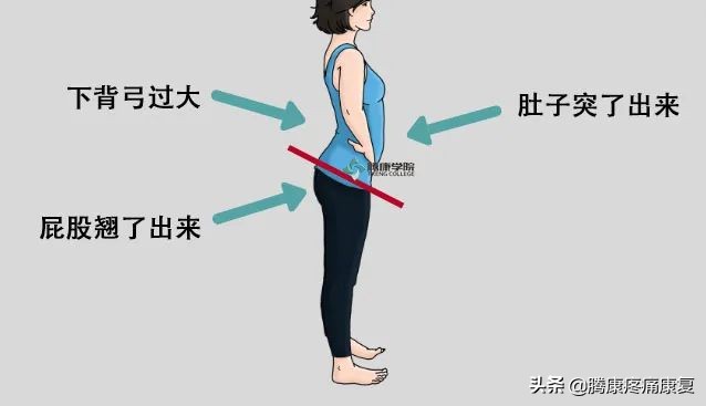 五个改善骨盆前倾的矫正拉伸训练