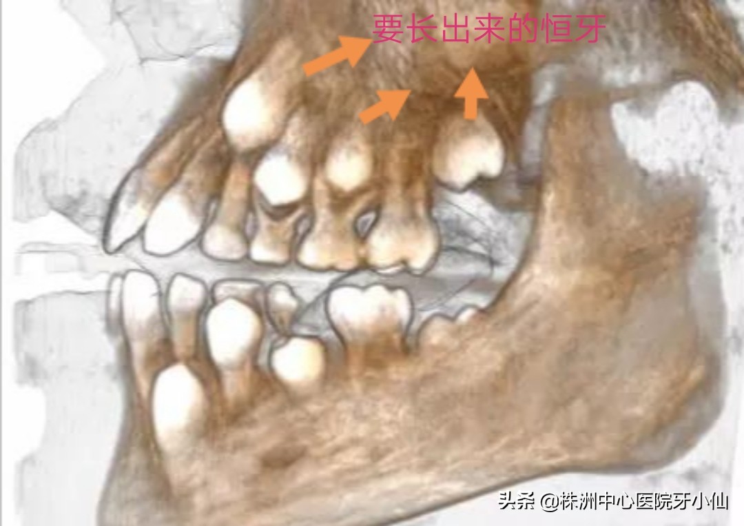 看个牙还需要拍CT？是真的有用，还是多此一举？#清风计划#