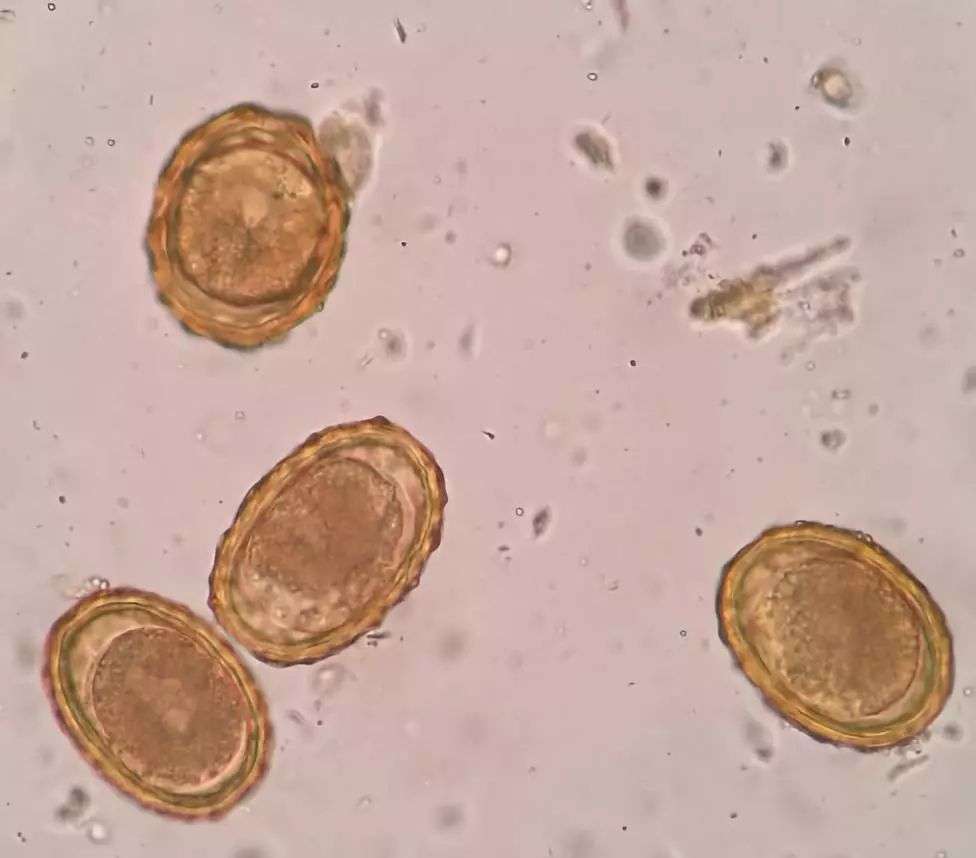 蛔虫卵图片(在过去) - 赤虎壹号
