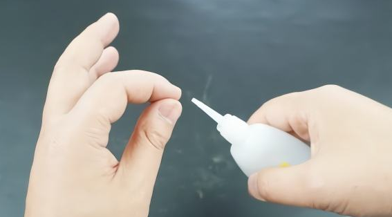 儿子卧室玩502胶水蹭一手，奶奶的做法很干脆，被医生点赞