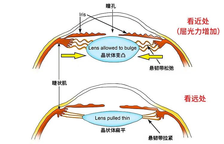 从小戴眼镜，但给你验光配镜的人有90%不合格