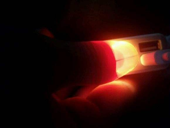 指甲上有条黑线是什么病？甲黑色素瘤or甲母痣？良性还是恶性？