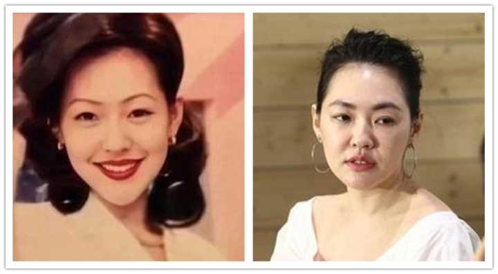发腮？咬肌肥大？方脸女孩不削骨磨腮如何变美？如何拯救时髦感？