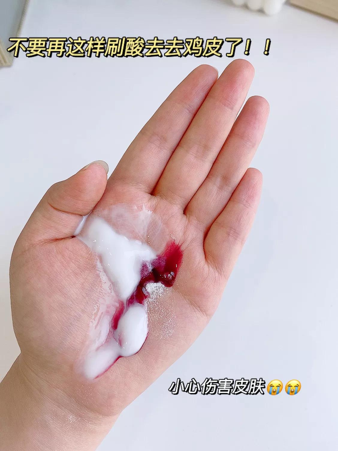 果酸美白真的有用吗（告诉你正确的果酸变白做法）