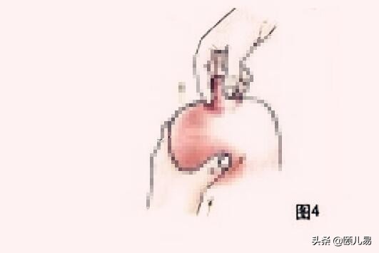 催奶按摩的手法示意图 下奶效果立竿见影