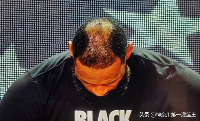 为什么nba球星都秃头(比普通人都要强壮，为何妖刀、杜兰特和詹姆斯都会早早谢顶？)