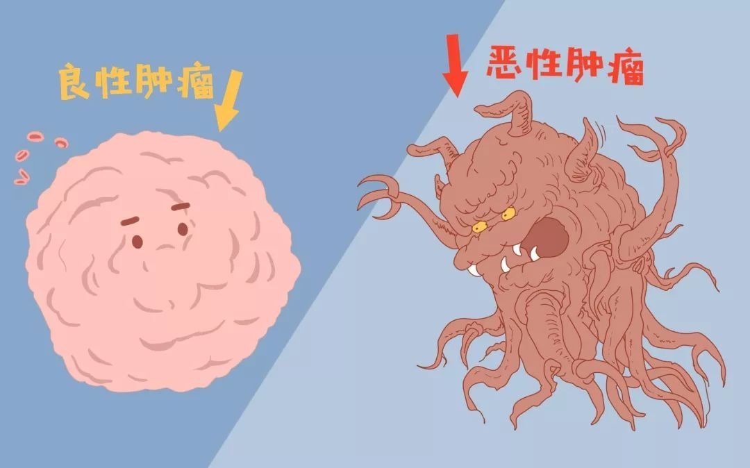 权威发布：十大真正有效的抗癌“克星”清单