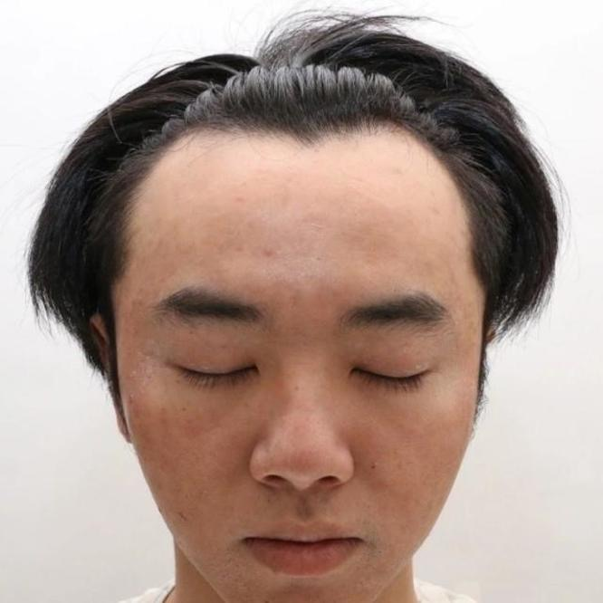 都说整容是娱乐圈“大忌”，而这10位明星，却因整容走向人生巅峰