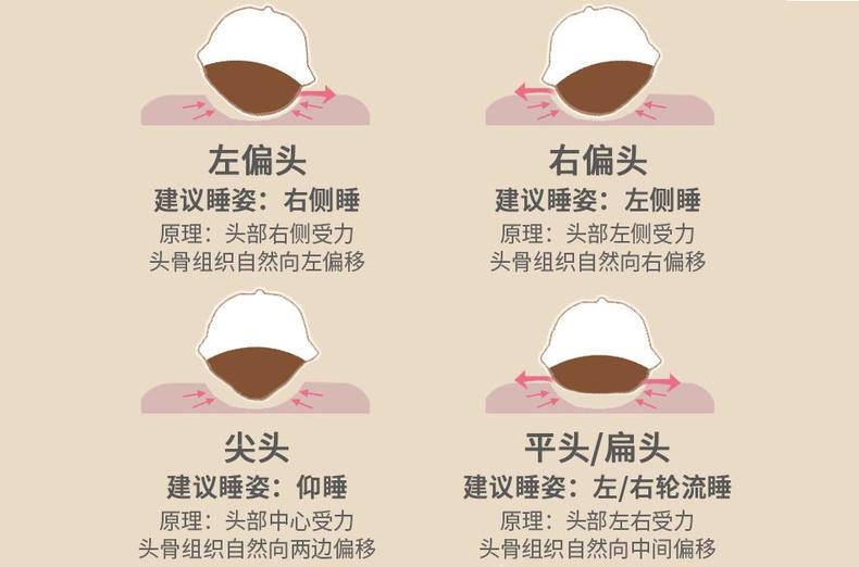 婴儿扁头矫正期最晚(如何防止宝宝睡偏头) - 乐宝宝贝