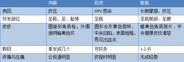 脚上长的是鸡眼、瘊子，还是老茧，你搞清楚了吗？