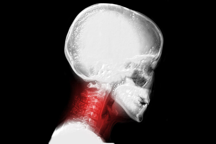 经常手麻、手痛，是血液循环不畅吗？不出意外，这5种可能性较大