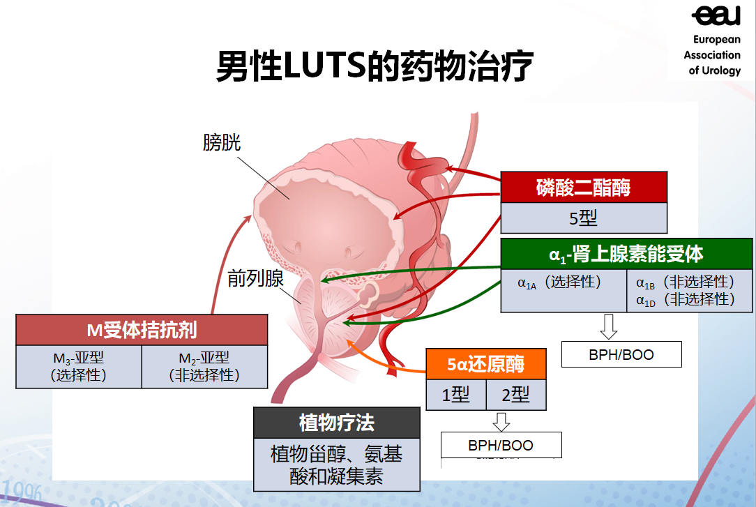 什么是良性前列腺增生症（BPH）？如何确定和治疗？