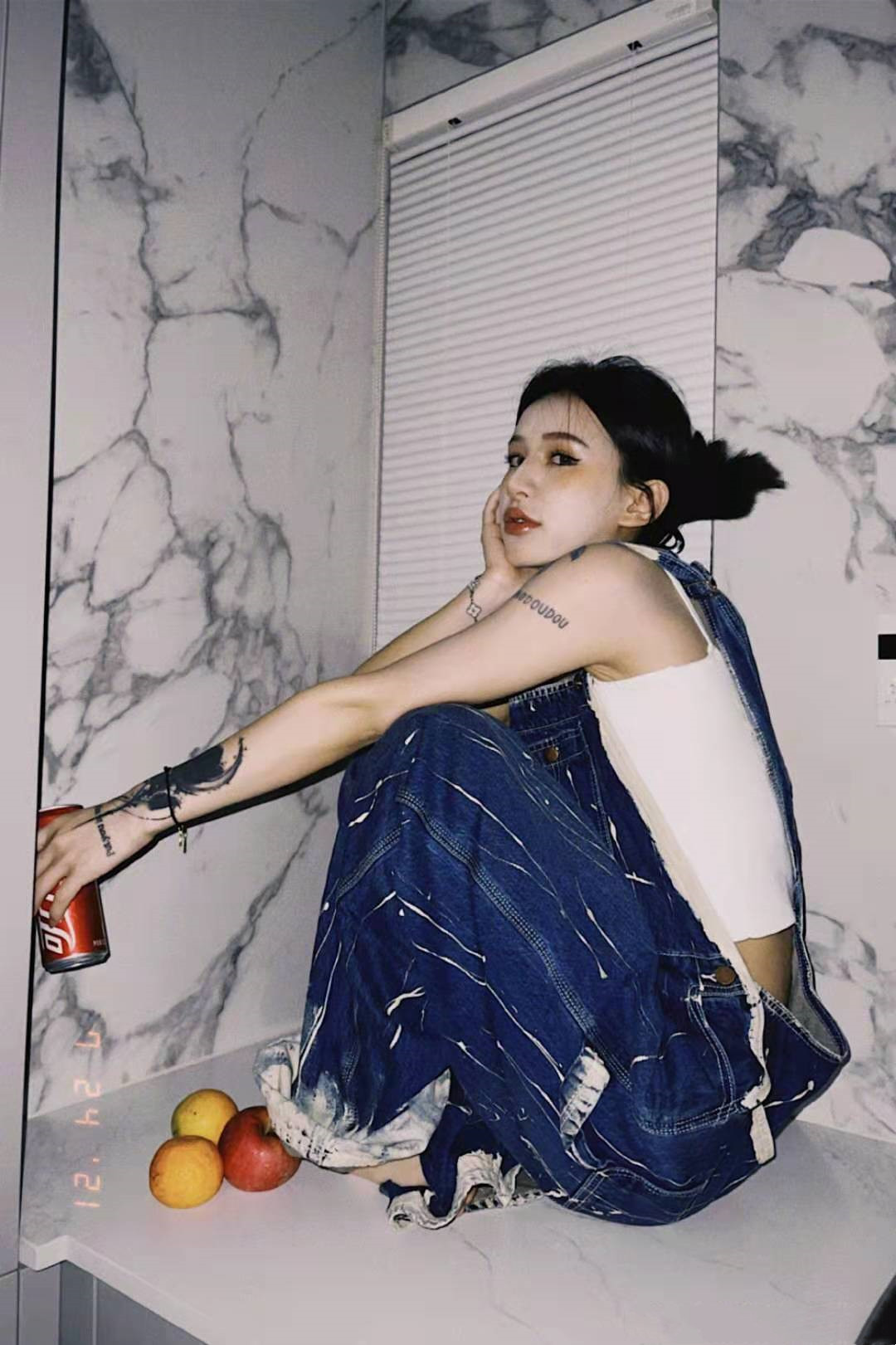 王逗逗晒出恋人车祸照,眼皮青紫又流血,万幸只是皮肉伤