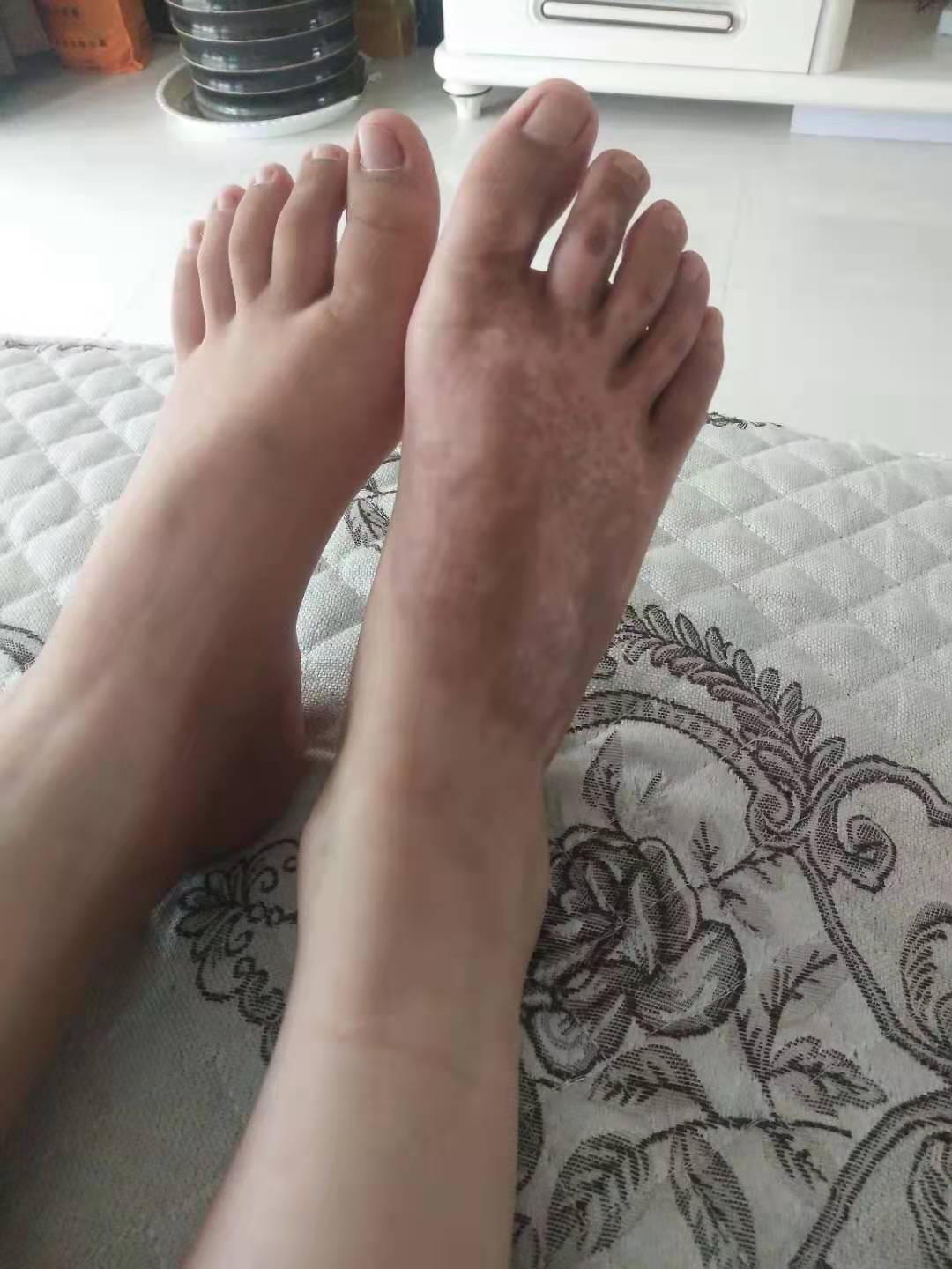 12岁小学生被老师安排搬营养餐烫伤，家长称学校给3000元后不再过问，校方：若索赔过多难承担