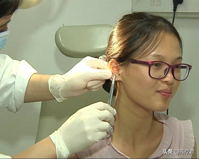 年轻女孩打耳洞后发炎红肿长疙瘩怎么办？