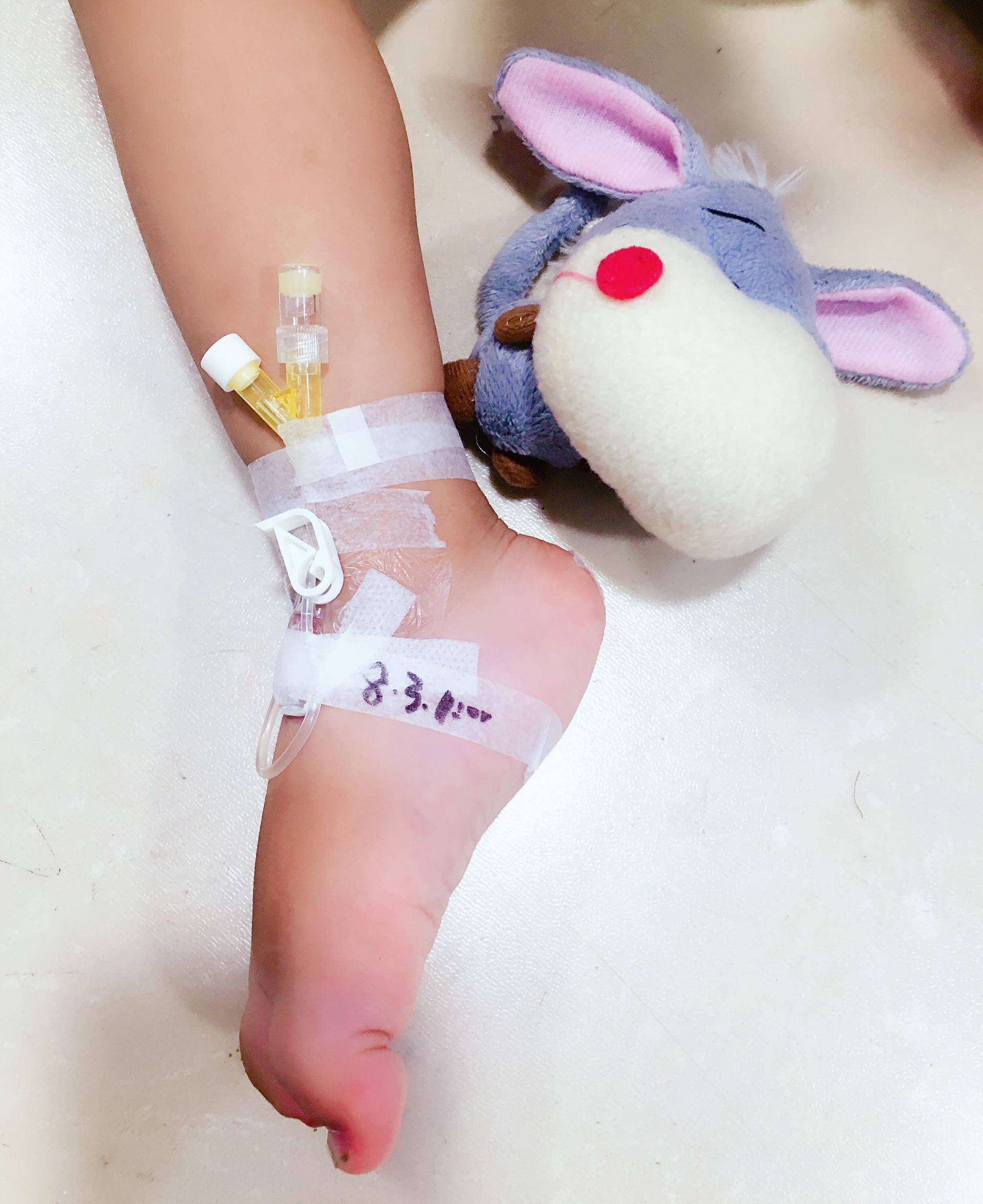 掌握儿童留置针居家护理10大要点,宝宝安全,妈妈安心