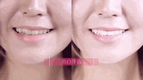 你知道“小巨蛋”吗？10s抗糖美白牙齿，效果比洗牙好太多了