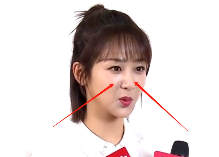 杨紫鼻子高度一般,肉嘟嘟脸蛋明显!