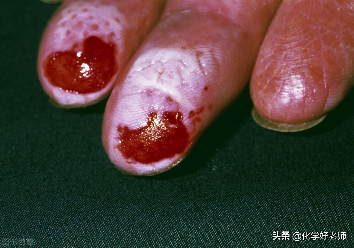 碱的化学式有哪些（详解常见碱的性质和用途）