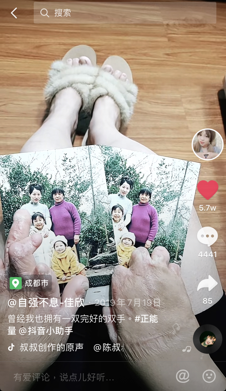 残疾、伤疤、贫困、辍学、年入百万……一个95后女孩的自强之路