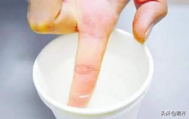手上粘着502胶水，不用担心，用一个小东西擦一擦，立马干净