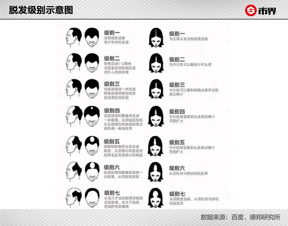 华晨宇被爆植发背后:中国有2.5亿人脱发,90后开始秃了