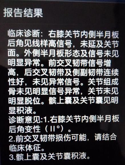 膝盖疼，诊断为半月板撕裂，还能恢复好吗？听听骨科医生怎么说！
