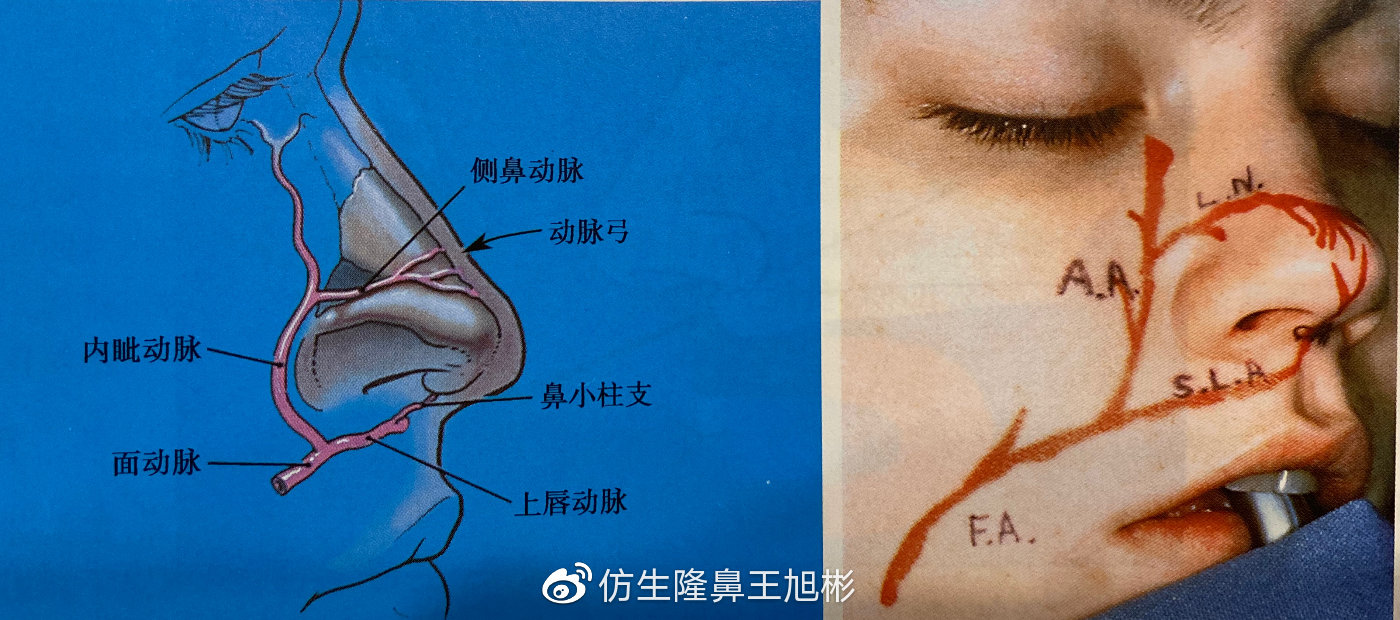 隆鼻整形的风险、危害和后遗症