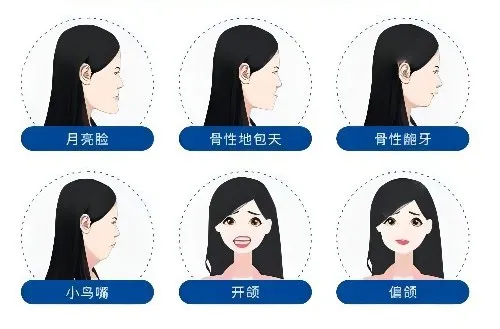 正颌手术和正畸正颌联合治疗有什么区别？