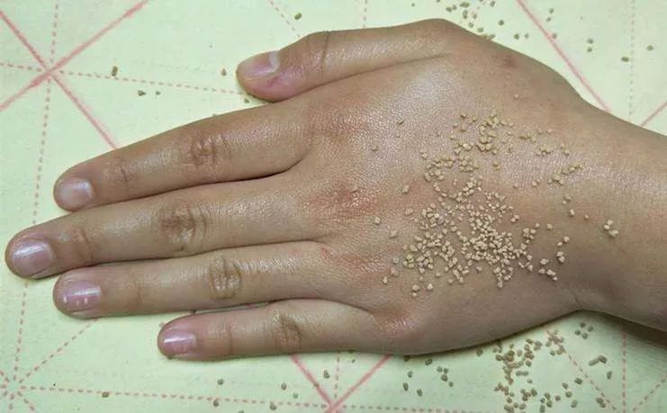 手纹深干燥、粗糙真显老！这支法国“换皮护手霜”，拯救干燥皱纹