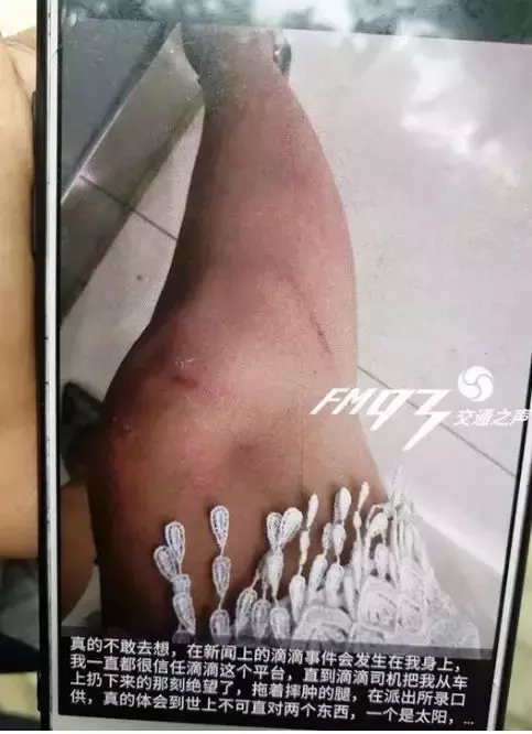 摸腿可免单?网约车性骚扰缘何屡禁不绝?
