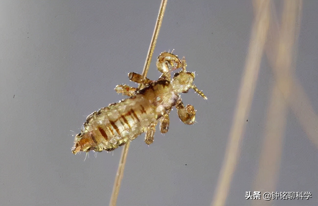 如何有效去除头发上的阴虱：与人类共同演化的寄生虫处理方法
