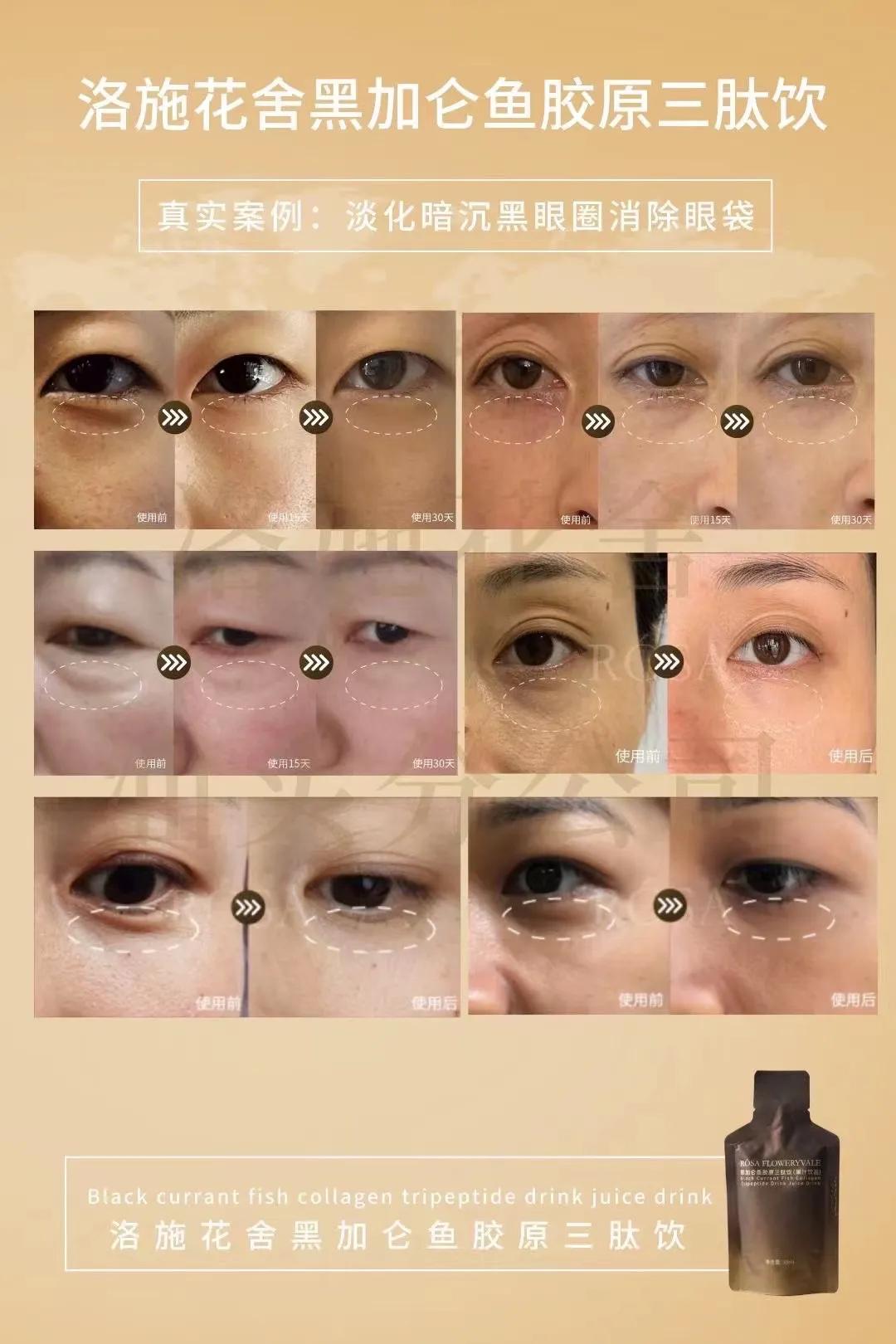 洛施花舍黑加仑抗衰饮效果怎么样？多少钱？