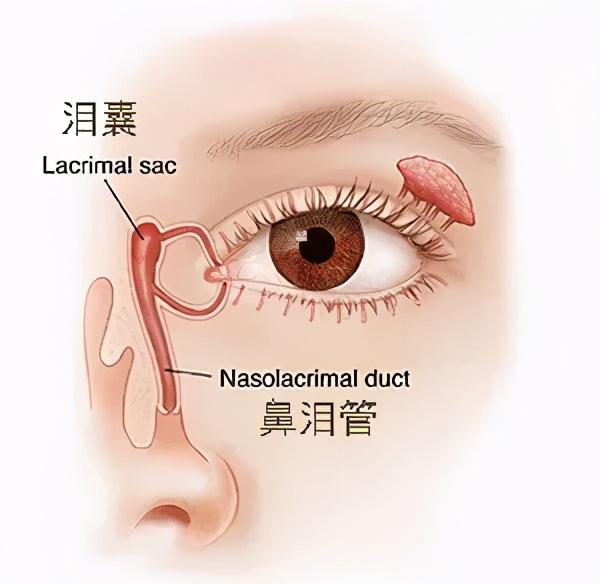 孩子总是泪汪汪、眼屎多，是什么情况？