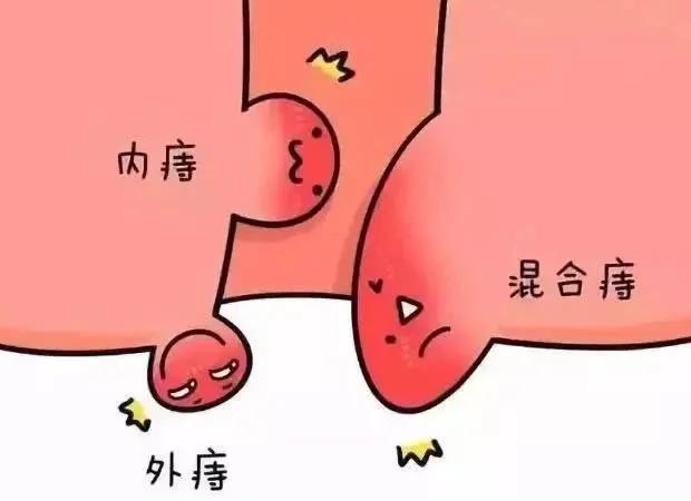 大便表面带血需警惕，可能是痔疮、肛裂或肠道疾病，建议及时就医检查。