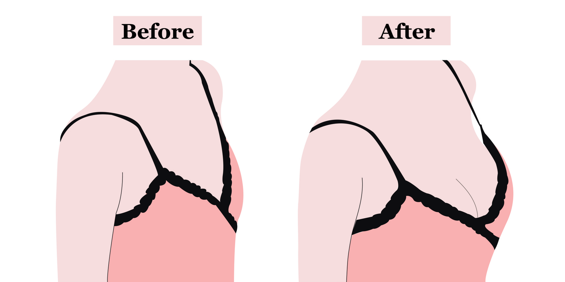 木瓜真能丰胸?如何促进乳房二次发育?专家建议:这样做效果最好