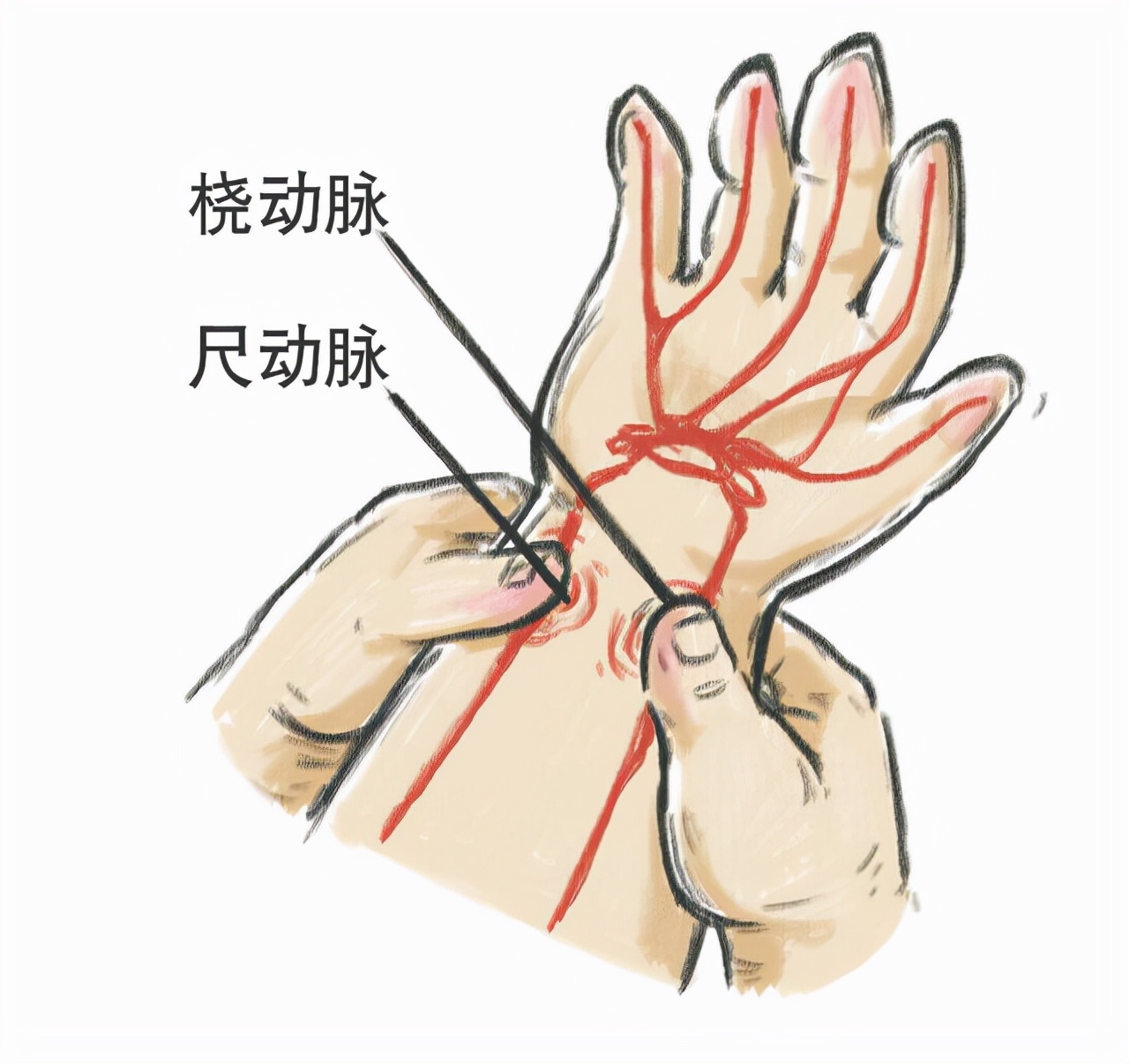宣告死亡,宣告死亡的条件和程序