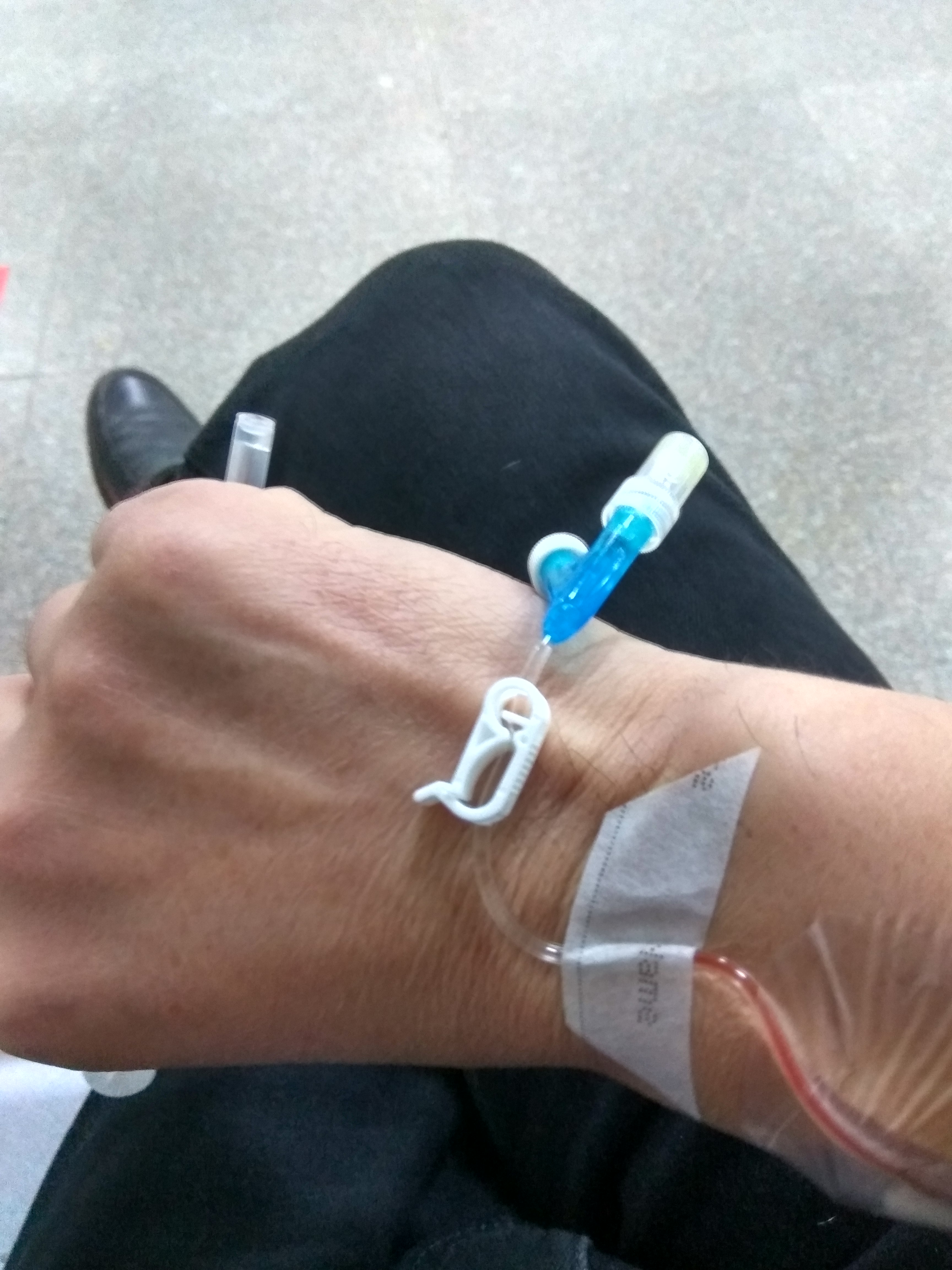 做个增强ct要多少钱做个增强ct要多少钱意味着什么