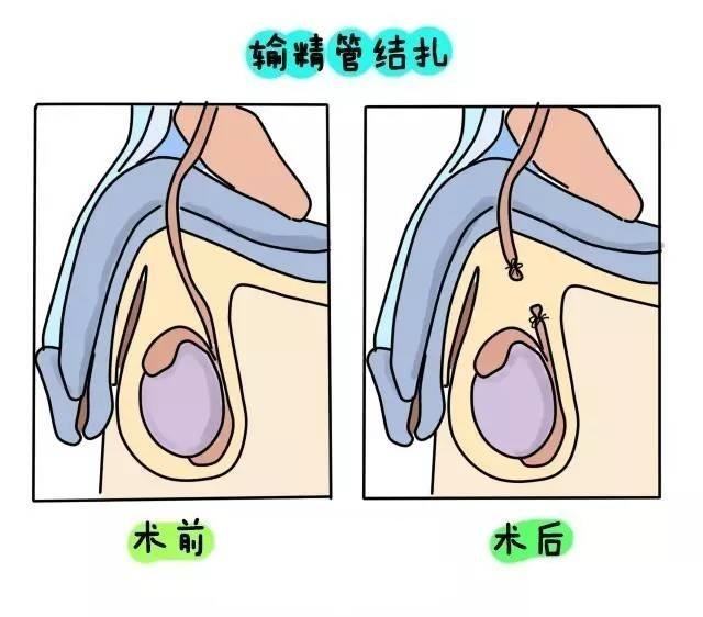 上环视频全过程图片(为何国外人流少) - 赤虎壹号