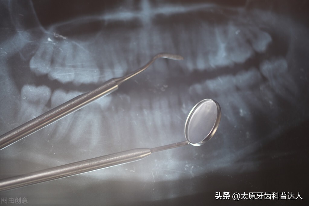 拔牙后要怎样护理伤口？
