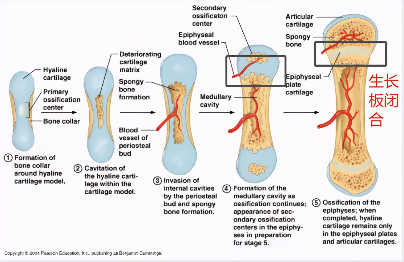 宝宝测骨龄成「新流行」？要不要测，看完这篇，心里有数