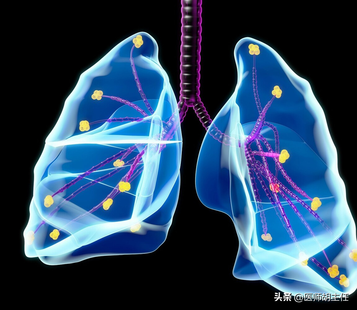 肺部疾病来临前，会先经历3个症状！发现1个，建议及早就医检查