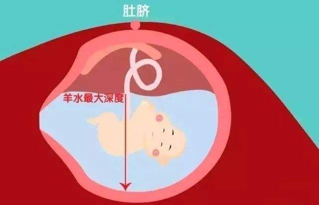 孕期做四维检查，了解这些指标，不用求医生，自己看胎儿是否健康